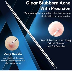 Blackhead And Acne Removal Needle Kit 4pcs