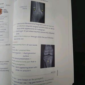 Marrow  Radiology Notes For NEET PG