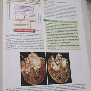 Robbins Basic Pathology