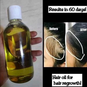 100ml Ayurvedic Hair Oil