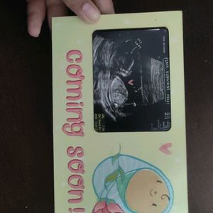 BABY COMING SOON Scan Photo Frame