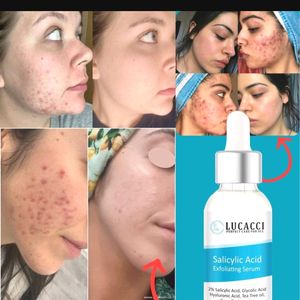 LUCACCI SALICYLIC ACID SERUM