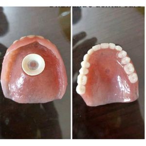 Dental Rubber Disc use in battise rpd tooth Battis