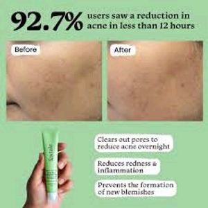 Acne Spot Gel Corrector