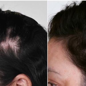 Rapid Regrow Hair Oil 100ml