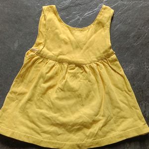 Yellow Baby Casual