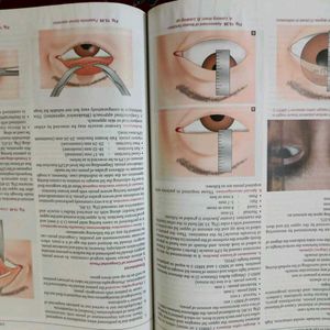 AK KHURANA -ophthalmology 8th edition