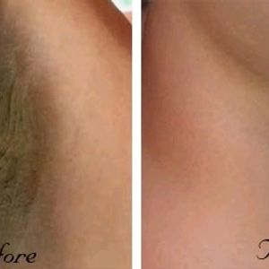 Sanfe Underarm Lightning Serum / Depigmentation