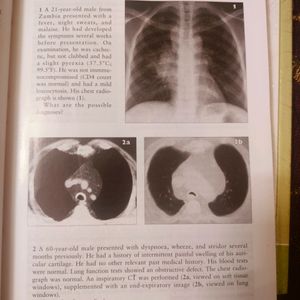 MBBS THORACIC IMAGING revision Cum Learning Book