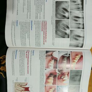 ENDODONTICS- NISHA GARG