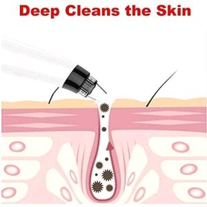 Derma Suction Black Head Remover