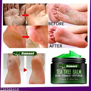 Tea Tree Balm For Crack Heels, Foot.