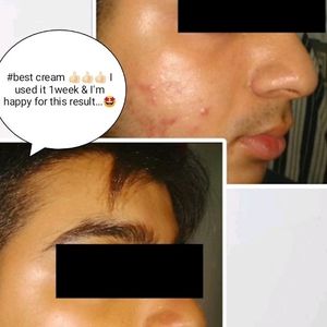 Fairness Cream 100% Results Money Back Gurantee If