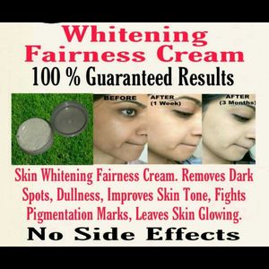 Skin Whitening Cream.