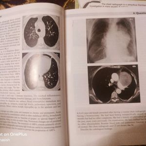 MBBS THORACIC IMAGING revision Cum Learning Book