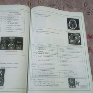 Prepladder Radiology PG Notes