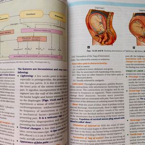 Datta's Obsestrics 10th Edition