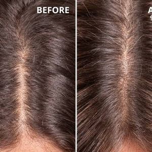 Regrow Rapid Hair Oil