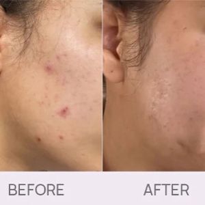 Bye-bye bumps Serum