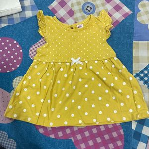 Baby frock