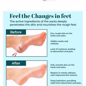 Moisturising Gel Socks for Cracked Heels