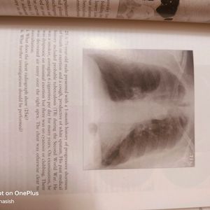 MBBS THORACIC IMAGING revision Cum Learning Book