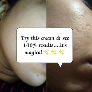 Fairness Cream 100% Results Money Back Gurantee If