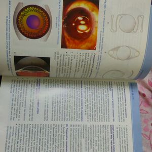 AK Khurana Opthalmology Book/Medical Book