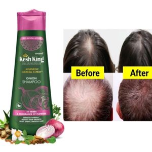 Kesh King Organic Onion Shampoo 300ml