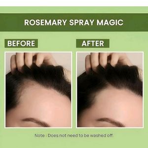 Fresh Rosemary Water For Hair Growth