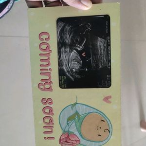 BABY COMING SOON Scan Photo Frame