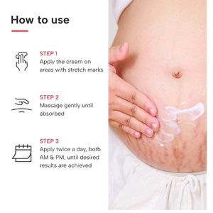 Dermatouch Stretch Marks Cream