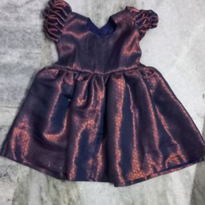 kids frock