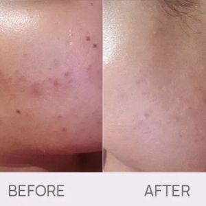 Bye-bye bumps Serum