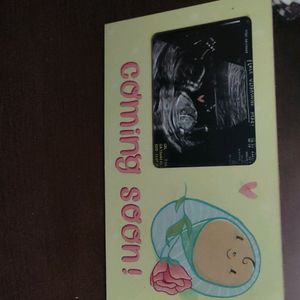 BABY COMING SOON Scan Photo Frame