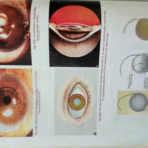 AK KHURANA -ophthalmology 8th edition