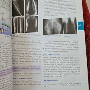 Textbook Of Orthopaedics For UG