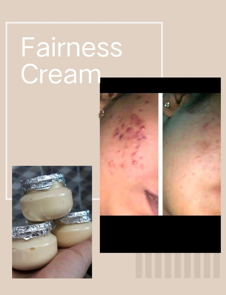 Fairness Cream