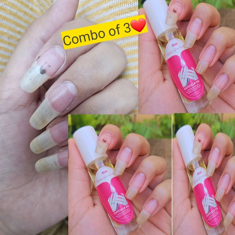 Combo Of 3 NAIL OIL