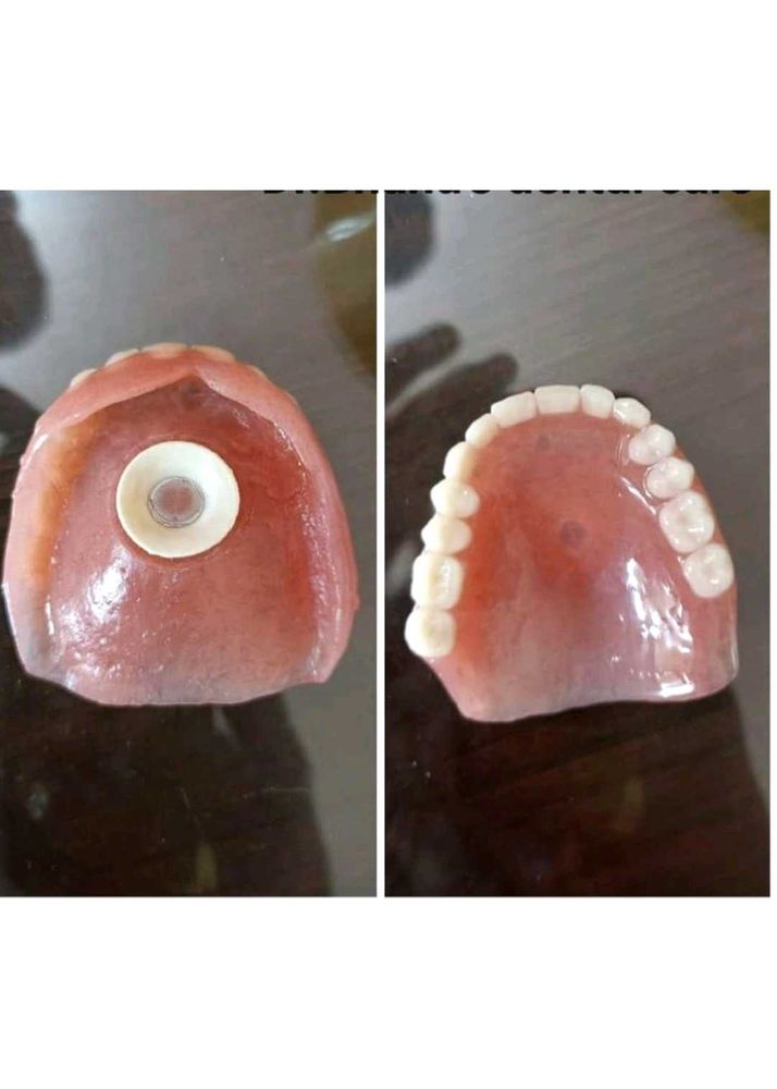 Dental Rubber Disc use in battise rpd tooth Battis