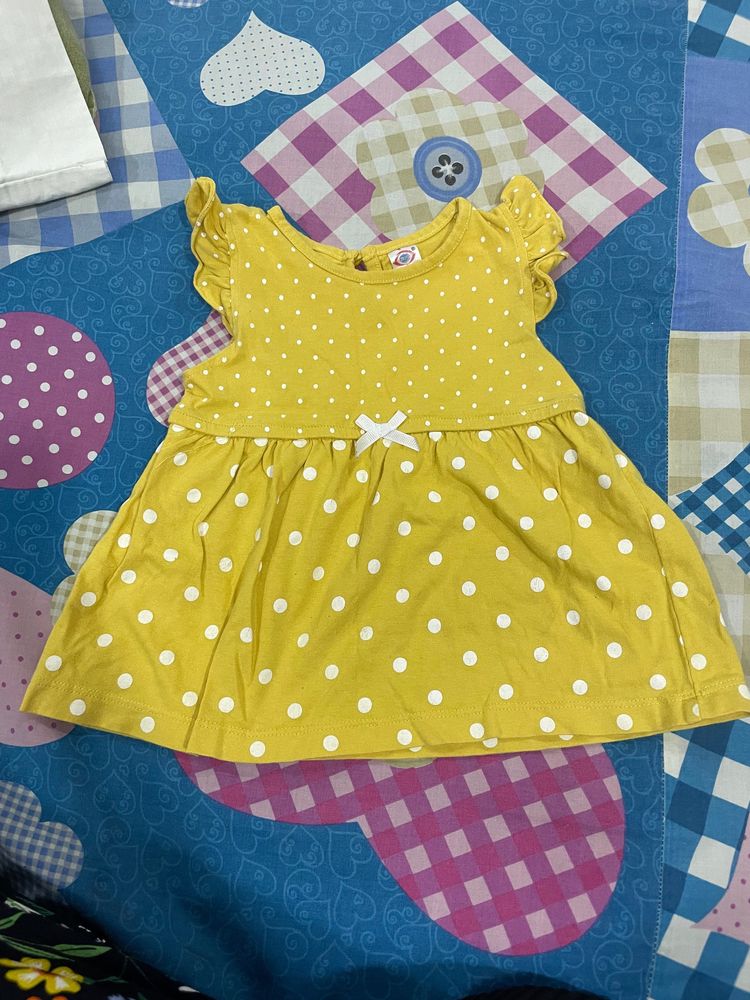 Baby frock