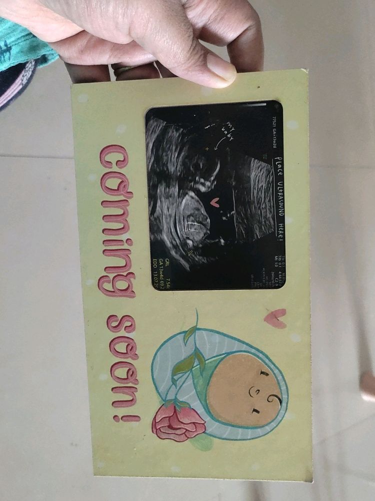 BABY COMING SOON Scan Photo Frame